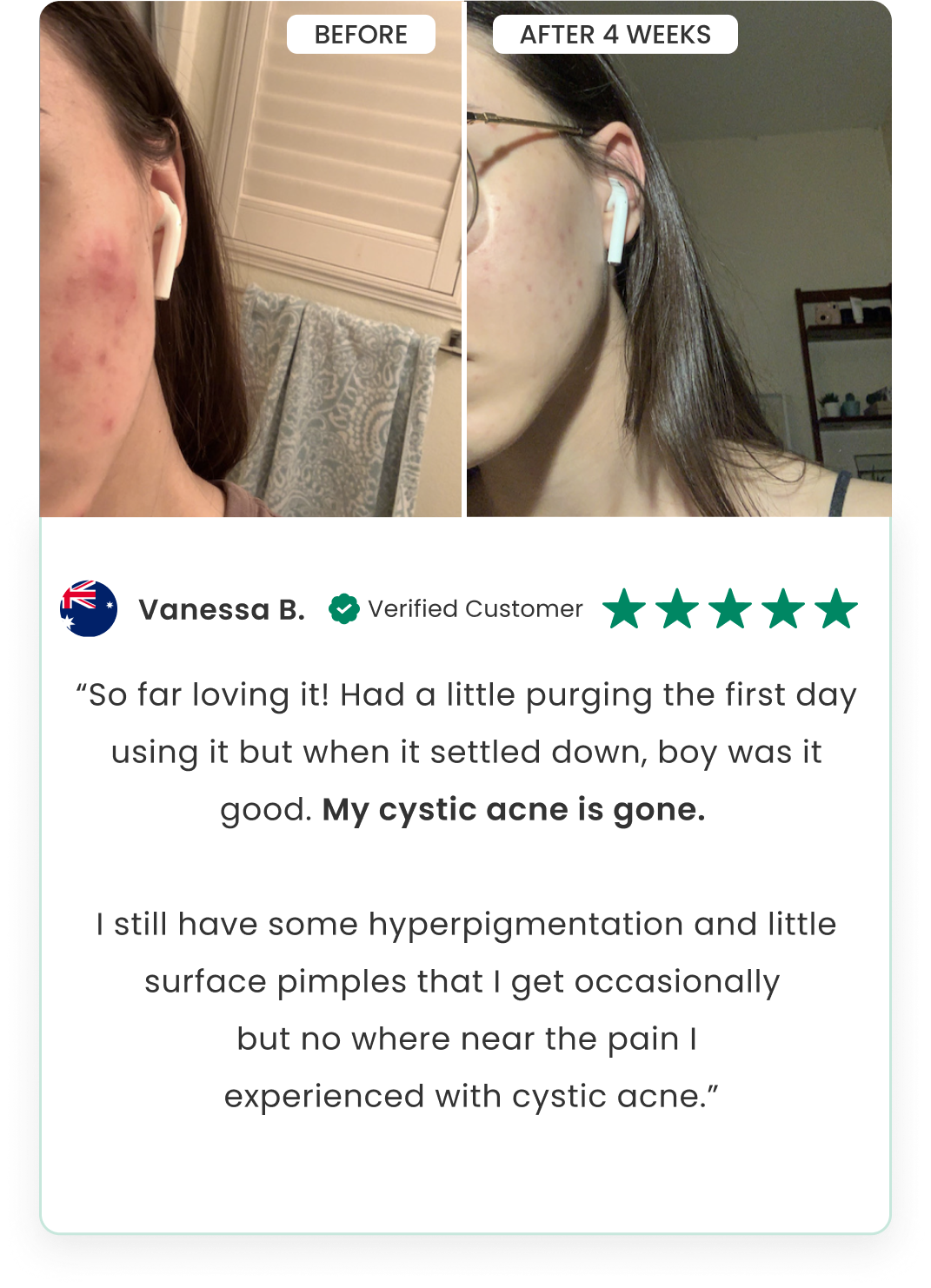 AllInOne Face Serum Qure Skincare